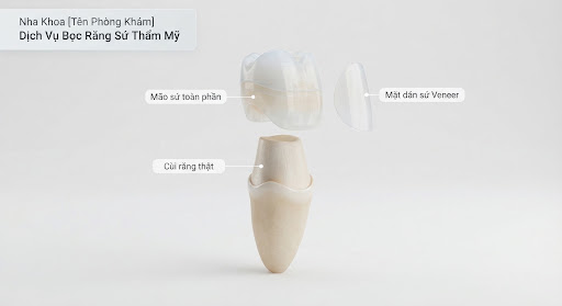 Thiết kế chuẩn tỉ lệ nụ cười DSD