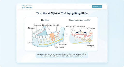 Bảo vệ răng hàm số 7 ăn nhai quan trọng